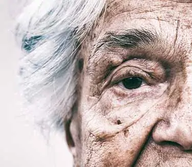 old woman with wrinkles and sun damage