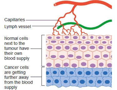 blood supply to tumor
