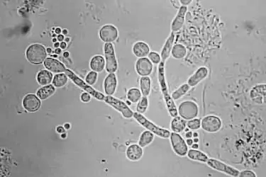 Candida albicans colony under microscope