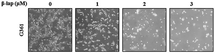 G361 cells under microscope