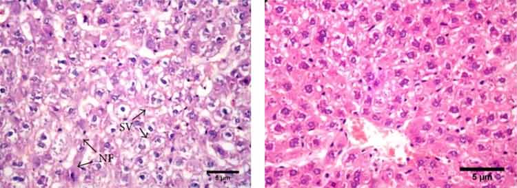 improvement in alcohol damage liver treated with gooseberries