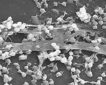 Staphylococcus aureus biofilm growing on a catheter